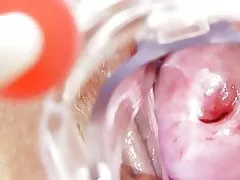پرستار کثیف می شود فقط